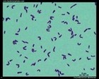 Corynebacterium diphtheriae microscopy